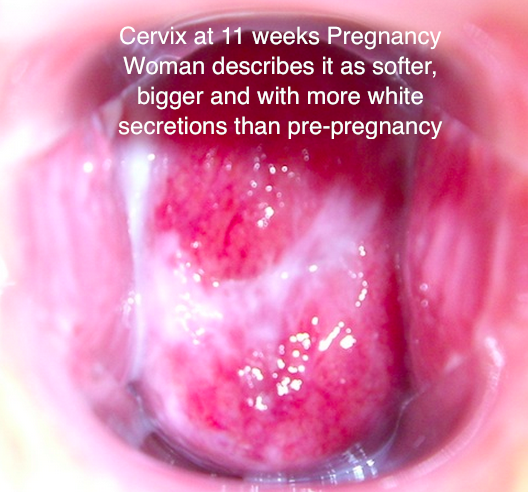 What does cervical mucus look like in pregnancy?